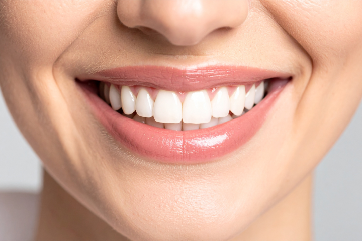 Aesthetic smile makeover result by Dr. Maria Smith featuring professional cosmetic dentistry and teeth whitening services.