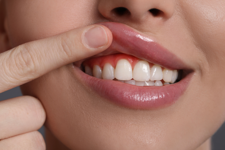 Periodontal health exam at Dr. Maria Smith's practice showing expert gum disease prevention and treatment in Shelton, CT.